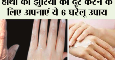 Adopt these 6 home remedies to remove wrinkles from hands